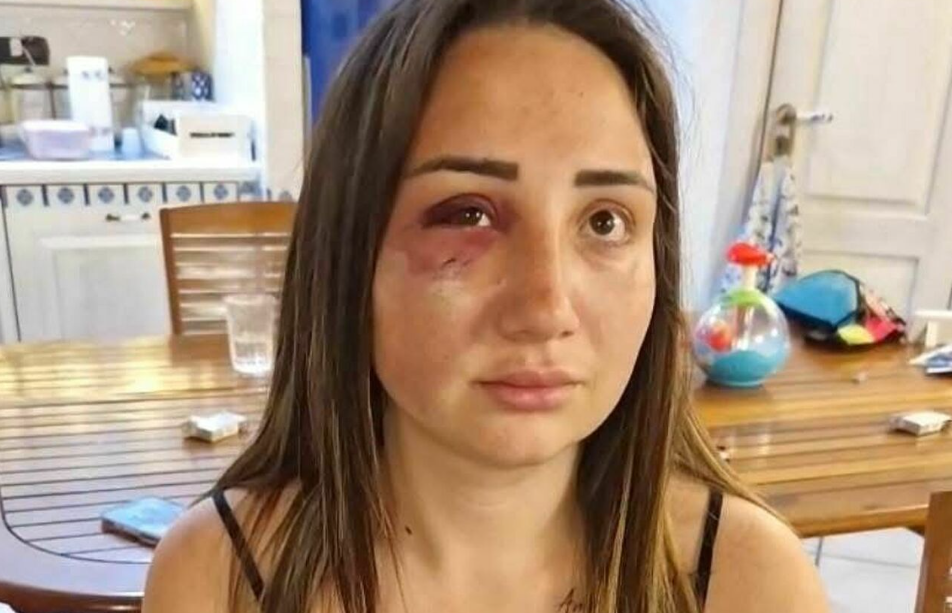 Aggredita dall’ex e da due complici: Gaia, mamma 25enne, salvata per miracolo