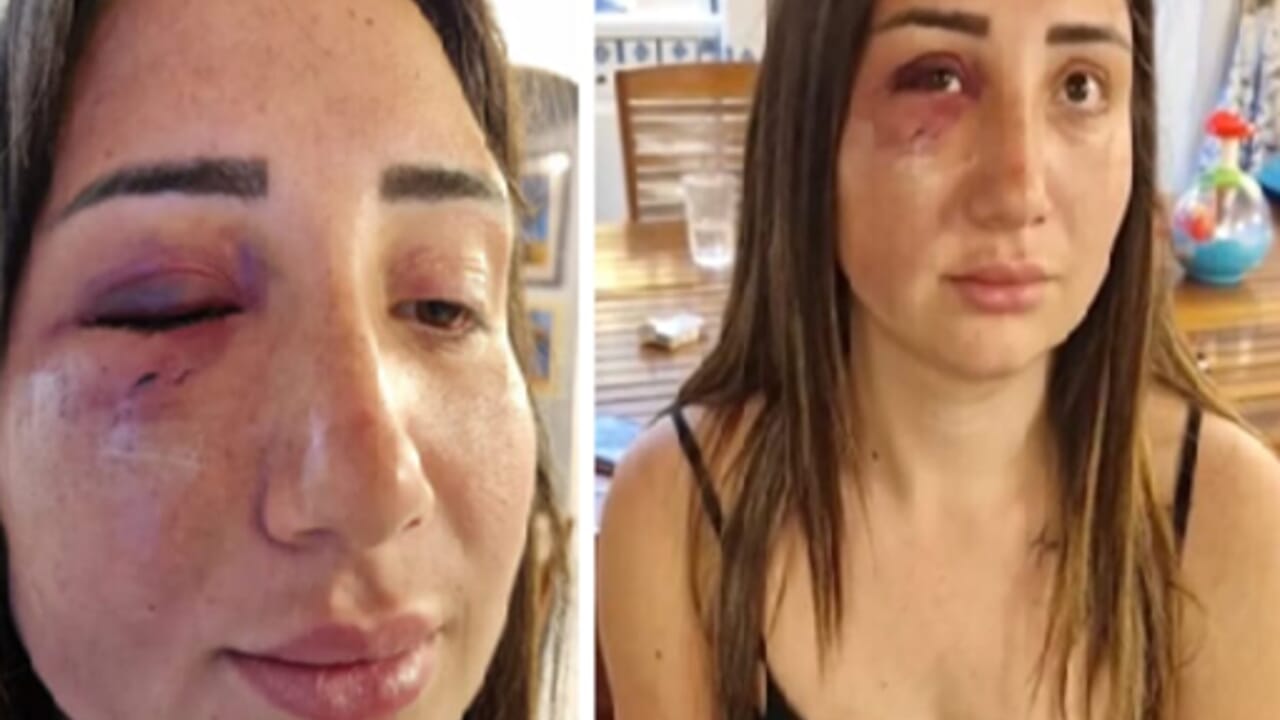 Orrore a Pozzuoli: picchiava l’ex compagna con il figlio di due mesi in braccio, il video lo mostra poi il tentato omicidio al belvedere