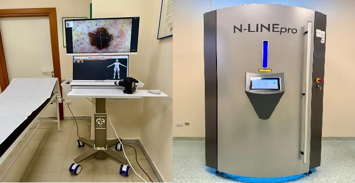 Al San Pio arrivano il videodermatoscopio e la cabina di fototerapia – NTR24.TV